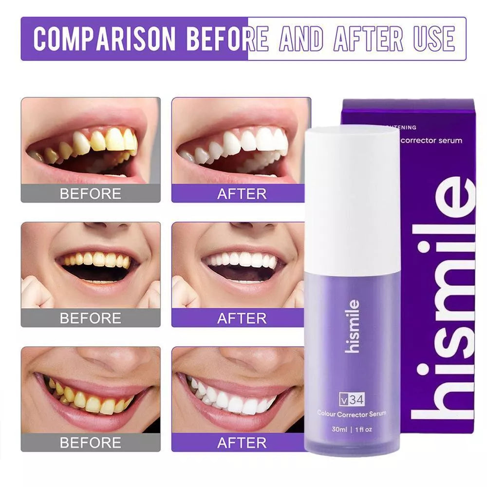 V34 purple pigment whitening serum for yellow teeth correction