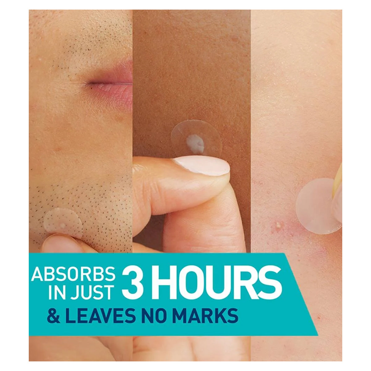 Cerave Blemish Barrier Patches 22Pcs
