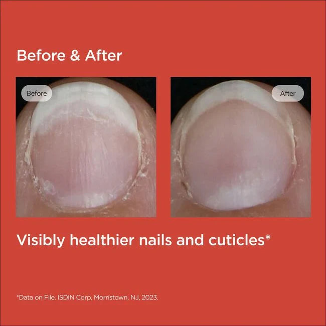 Isdin Si-nails Nail Strengthener 2.5ml