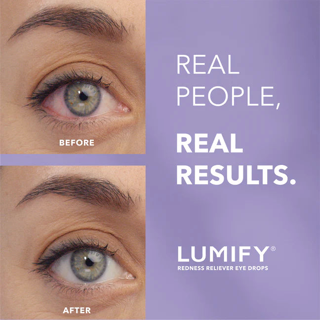 Lumify eye drops for redness relief