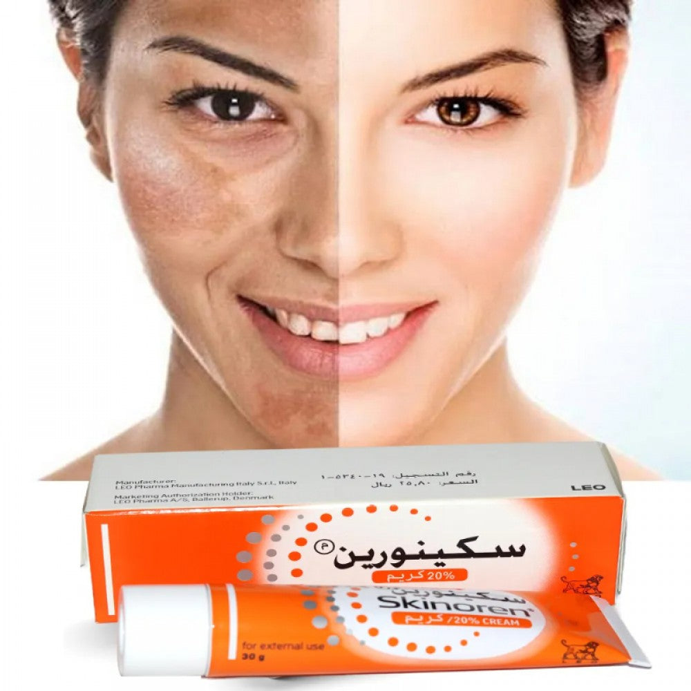 Skinoren Cream 20% Azelaic Acid – Acne & Hyperpigmentation Treatment 30g | HEALTH BOUTIQUE Jordan