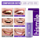 V34 purple pigment whitening serum for yellow teeth correction