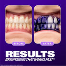 V34 purple pigment whitening serum for yellow teeth correction