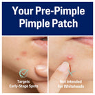 Cetaphil Gentle Clear Hydrocolloid Pimple Patches for Acne Treatment - 24 Count