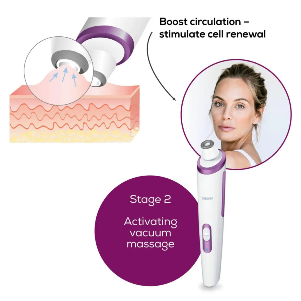 Beurer Microdermabrasion - FC 76