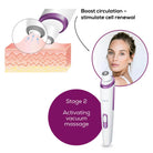 Beurer Microdermabrasion - FC 76