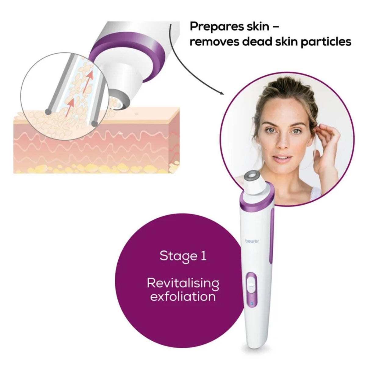 Beurer Microdermabrasion - FC 76