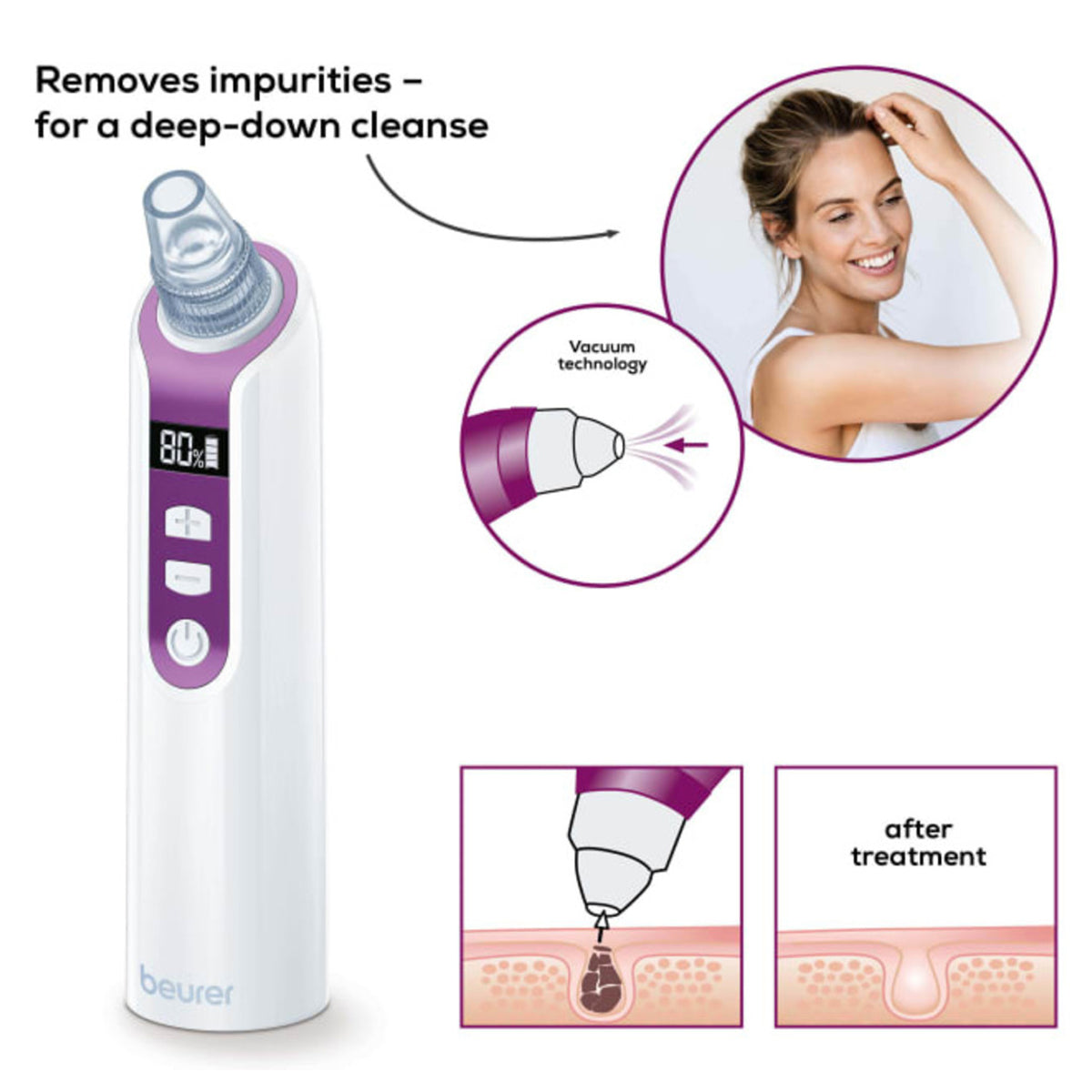 Beurer Pore Cleaner - FC 41