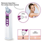 Beurer Pore Cleaner - FC 41