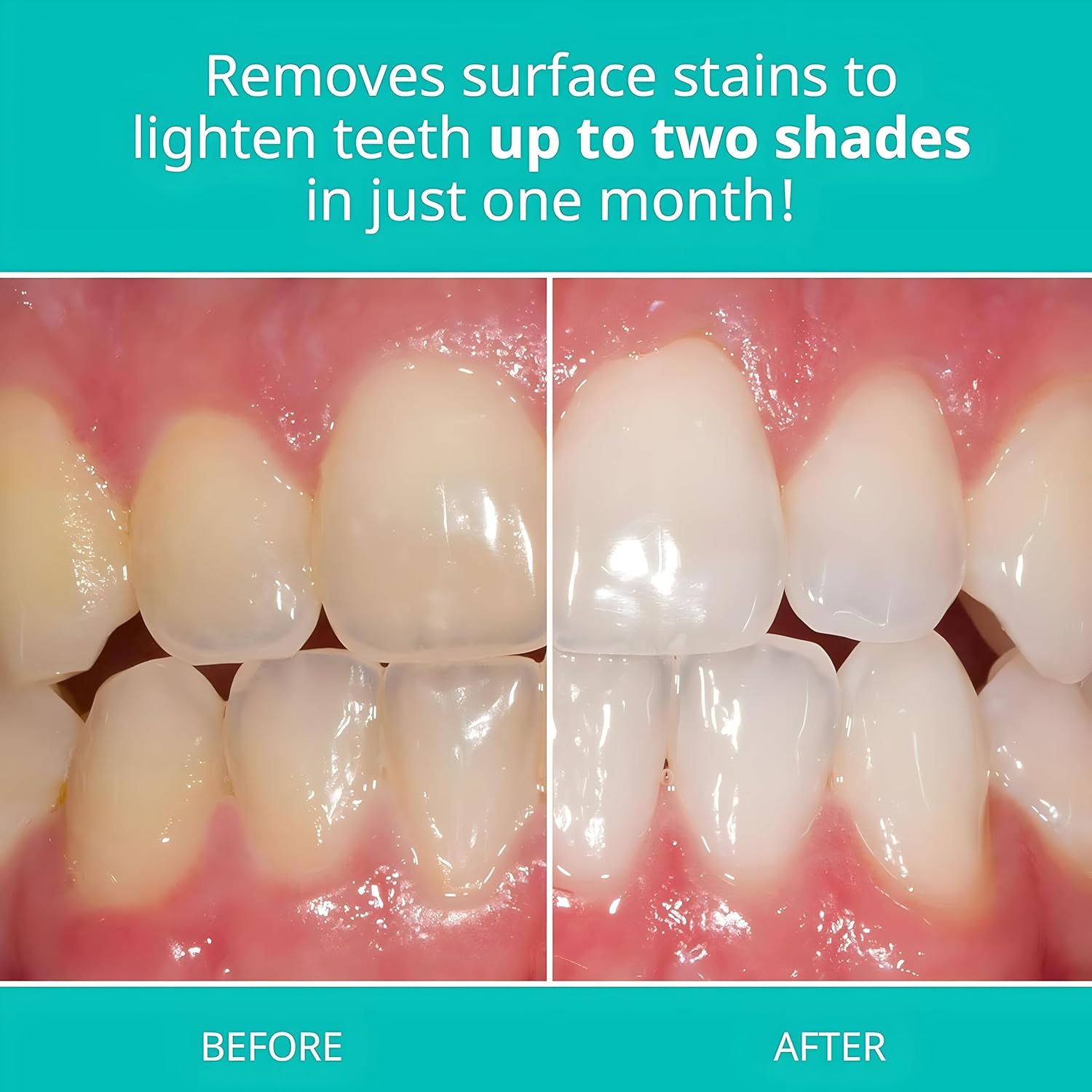 Opalescence Best whitening toothpaste recommended by dentists in Jordan and GCC