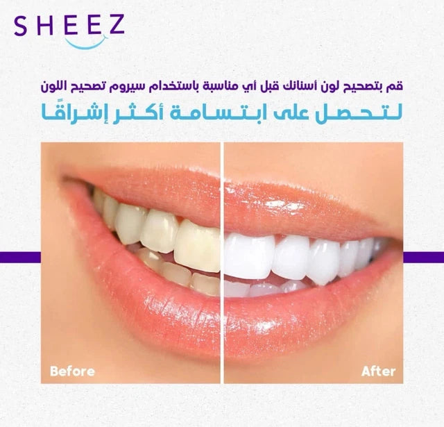 Purple pigment whitening serum neutralizing yellow teeth stains