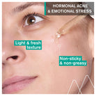Uriage Hyséac New Skin Serum Booster Anti-Imperfection 30ml exfoliating serum for blemish-prone skin Health Boutique