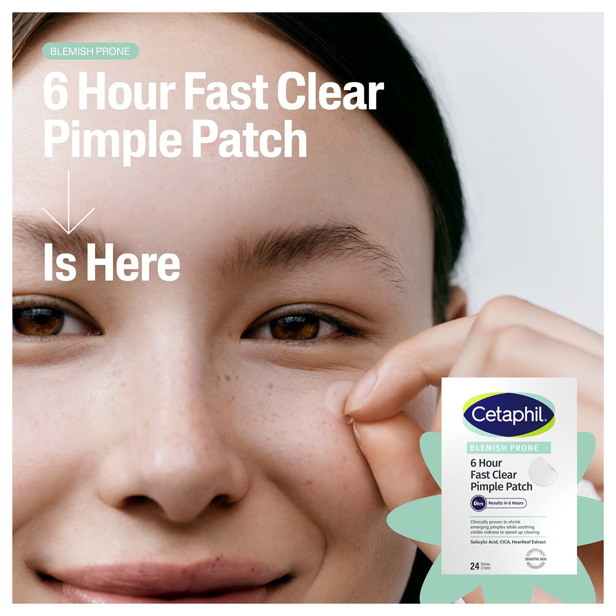 Cetaphil Gentle Clear Hydrocolloid Pimple Patches for Acne Treatment - 24 Count